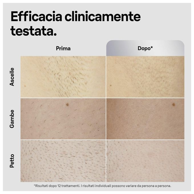 Braun Silk-Expert Pro 5 Epilatore Luce Pulsata con Custodia Rasoio Uomo Gillette 2 Testine