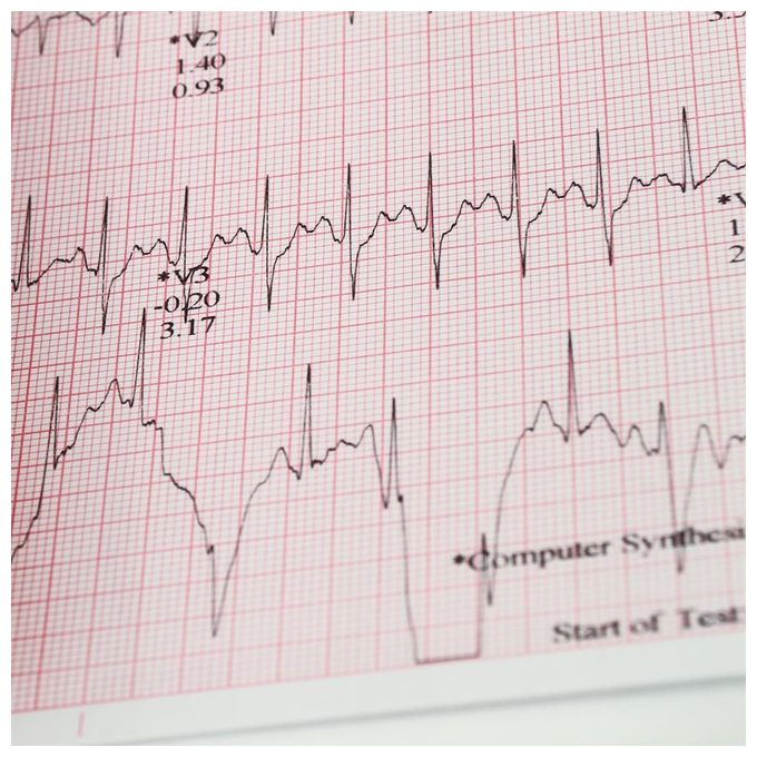 Carta Termica Ecg 210X140 Mm X 215 - Pacco Griglia Arancio conf. 10 pz.